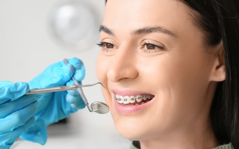 Read more about the article Orthodontic Treatment Timeline: What to Expect From Start to Finish