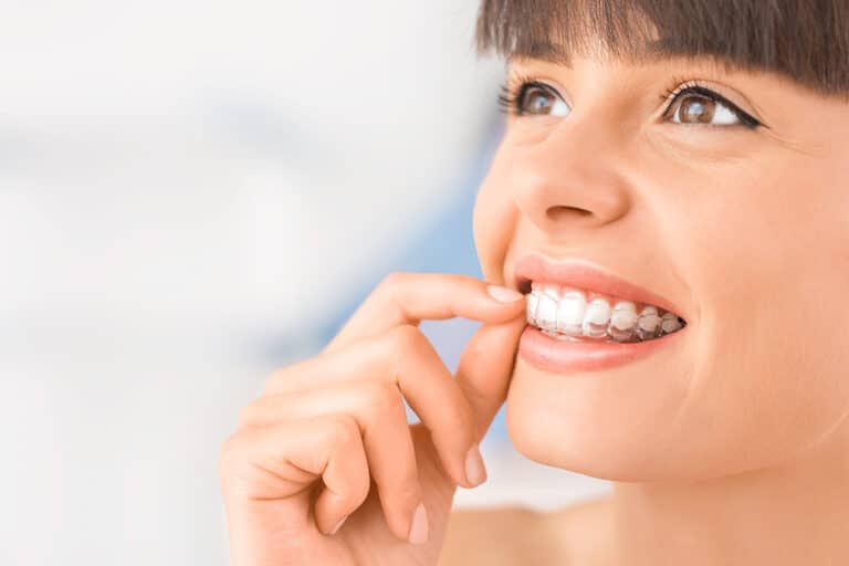 Smiling woman putting on clear Invisalign aligners, showing the lifestyle of wearing aligners daily