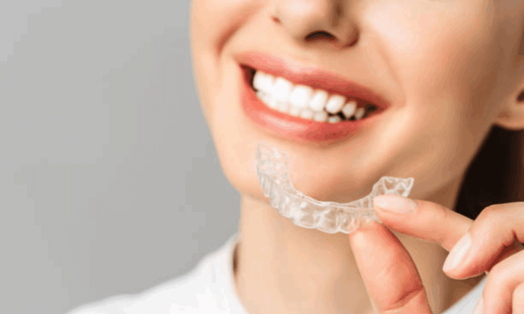 Close-up of a smiling woman holding a transparent clear aligner near her teeth, showing how discreet aligners appear up close.