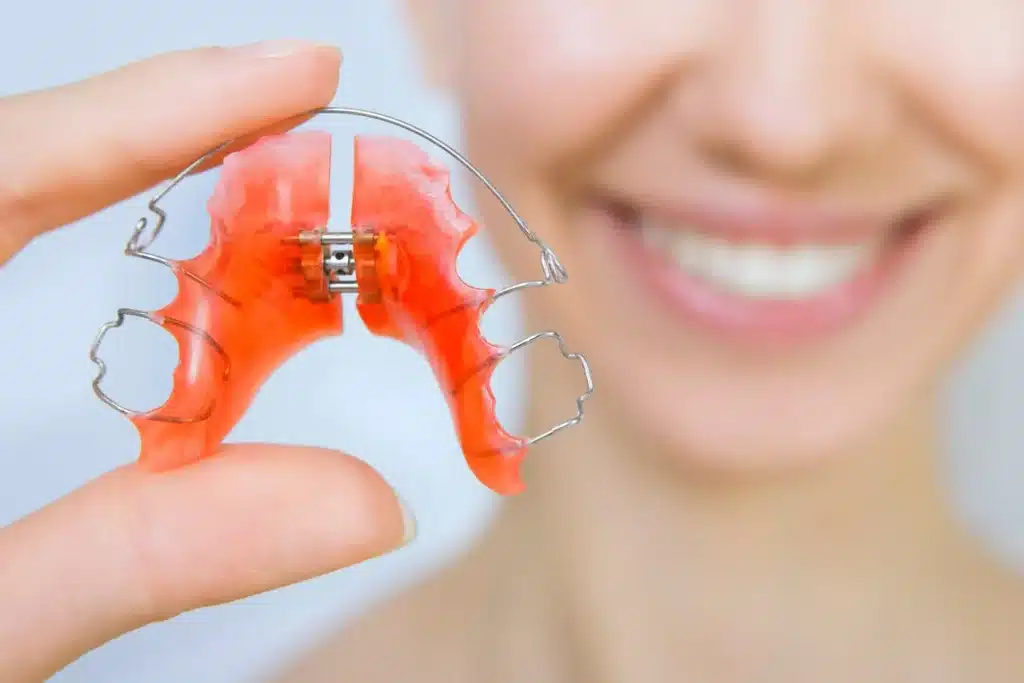 Close-up of a removable orthodontic retainer held in front of a smiling adult, illustrating the importance of retention after orthodontic treatment.